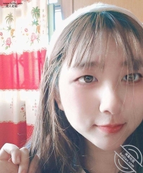 忍着不拔智齿的后果！！！脸上烂了个洞?